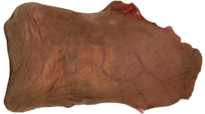 Foreskin